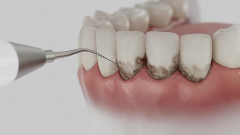 Reliable Emergency Dentist contractor in LaGrange, GA by Smile Center Dentistry
